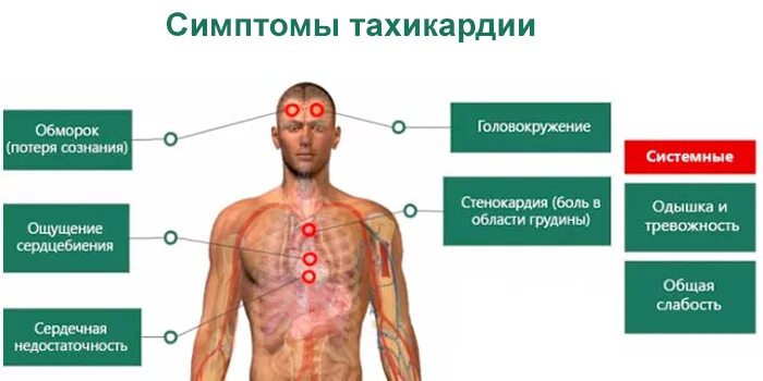 Сердцебиения тревожность. Симптомы учащенного сердцебиения. Тахикардия симптомы. Учащенное сердцебиение симптомы. Симптомы при тахикардии.