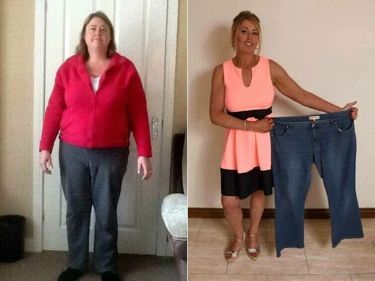 Похудение до и после. Похудение до и после фото. Похудевшая женщина. Похудела до и после.