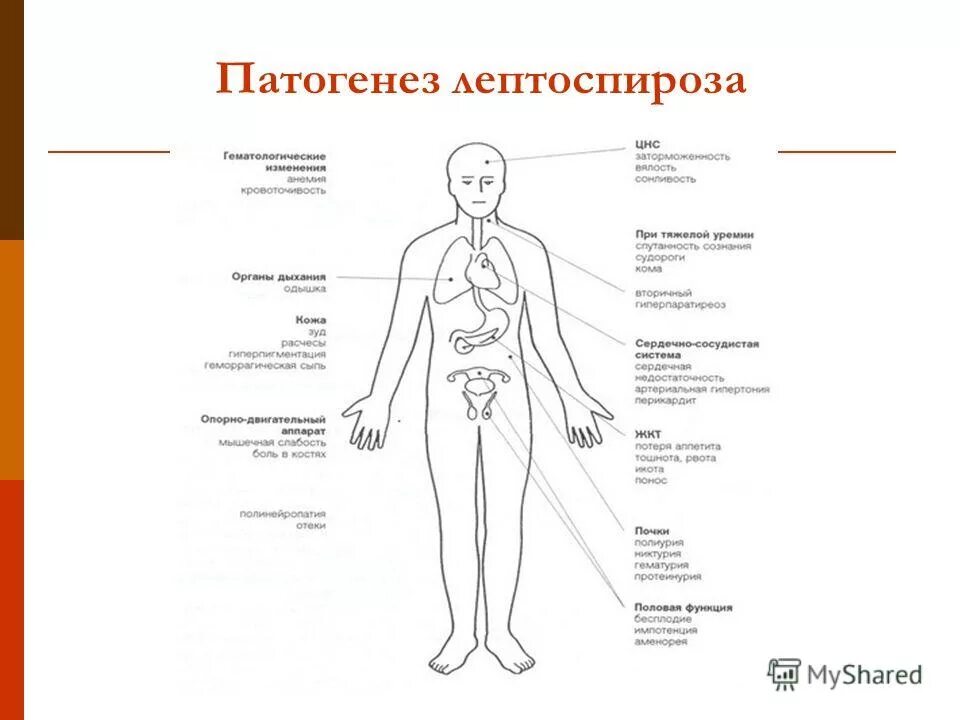 Лептоспироз патогенез. Лептоспироз патогенез схема. Лептоспироз клиника схема. Лептоспироз этиология. Фазы патогенеза лептоспироза.