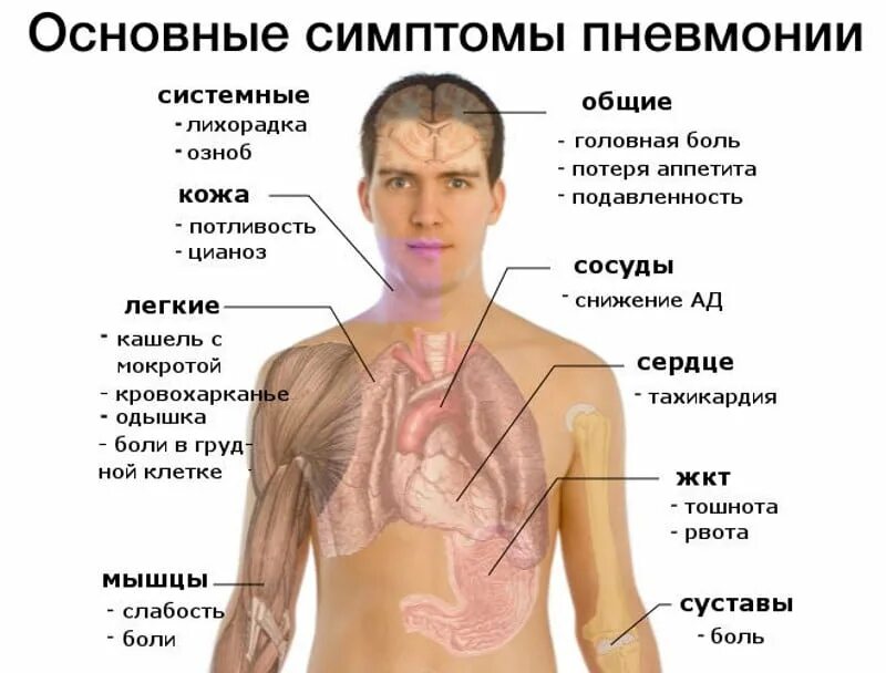 Заболевание с сильным кашлем. Основные симптомы при пневмонии. Воспаление лёгких симптомы. Восполении лёгких, симптомы.