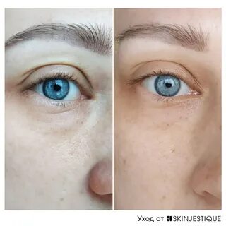 Ретинол skinjestique