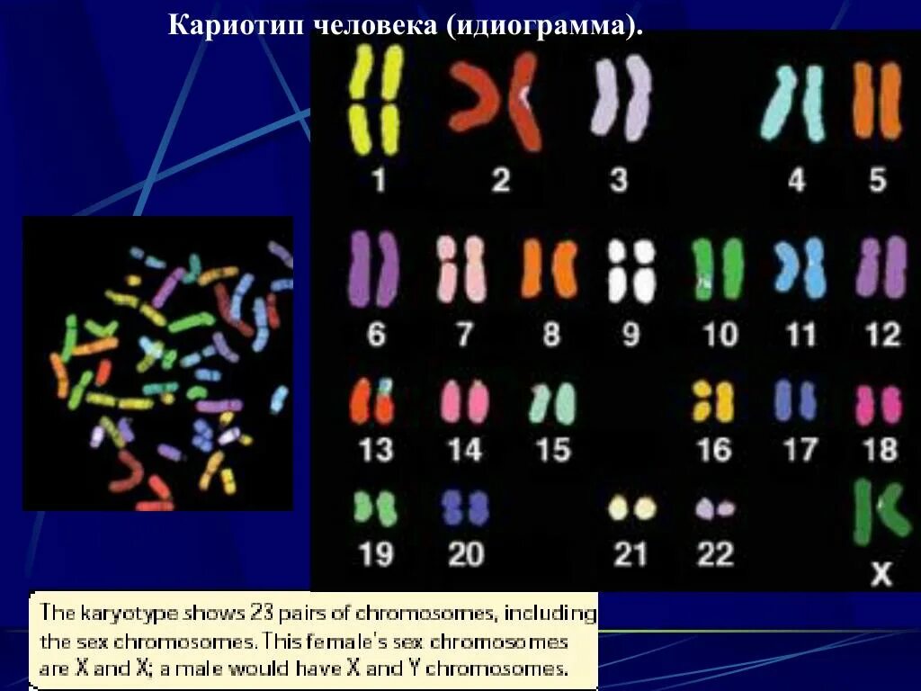 Кариотип человека определяют