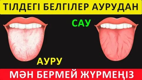 Қынаптық веб-камера