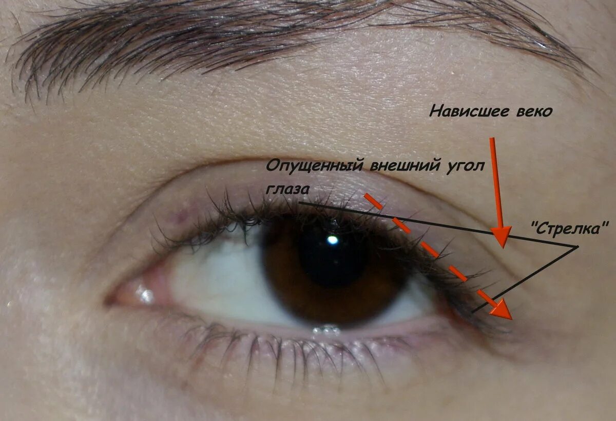 Стрелки для нависшего века и опущенных уголков. Стрелки на нависшее веко. Стрелки с нависшим веком. Стрелки доя опушенногоо уголка глаз. Нависшее веко как избавиться в домашних