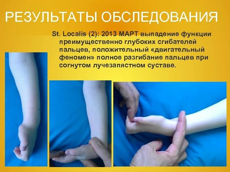 Статус локалис коленный сустав. St localis. статус локалис при артрозе кистей.