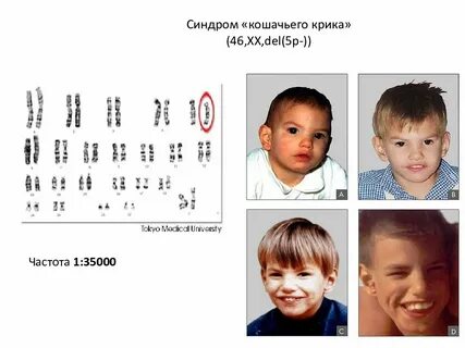 Признаки кошачьего крика
