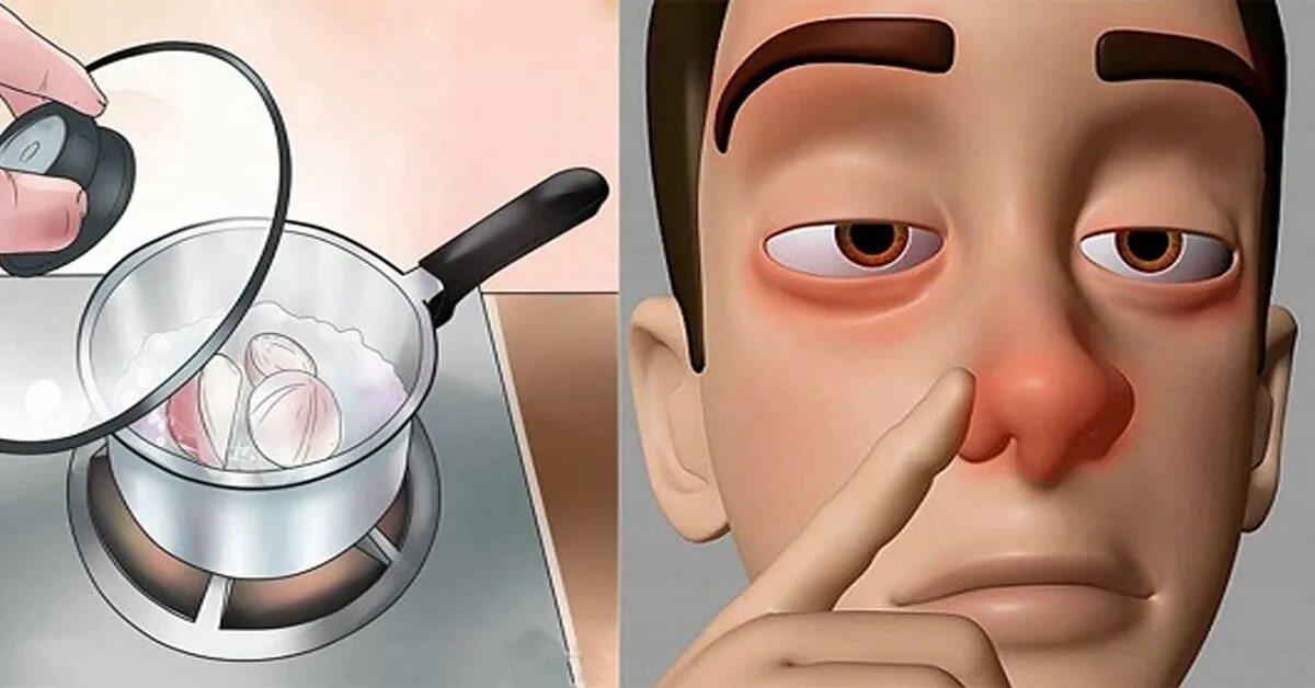 Заложенность носа насморка причины и лечение. Заложенность в носу домашними.