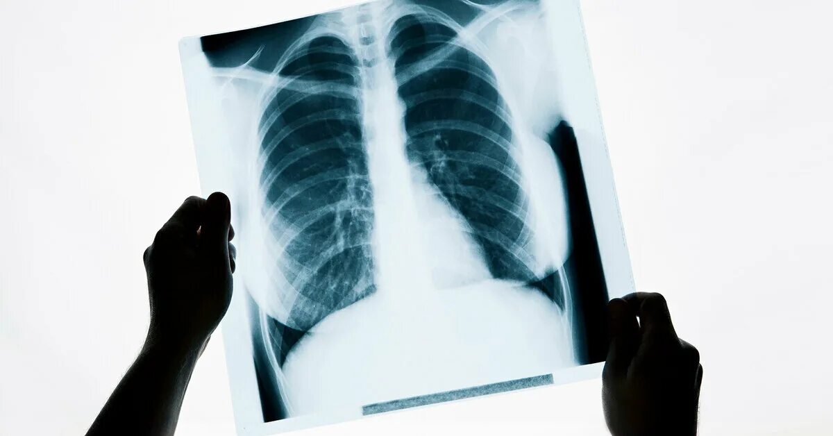Рентгеновские снимки. Рентген. Рентген со снимком. X-ray рентген. Рентген со снимком.