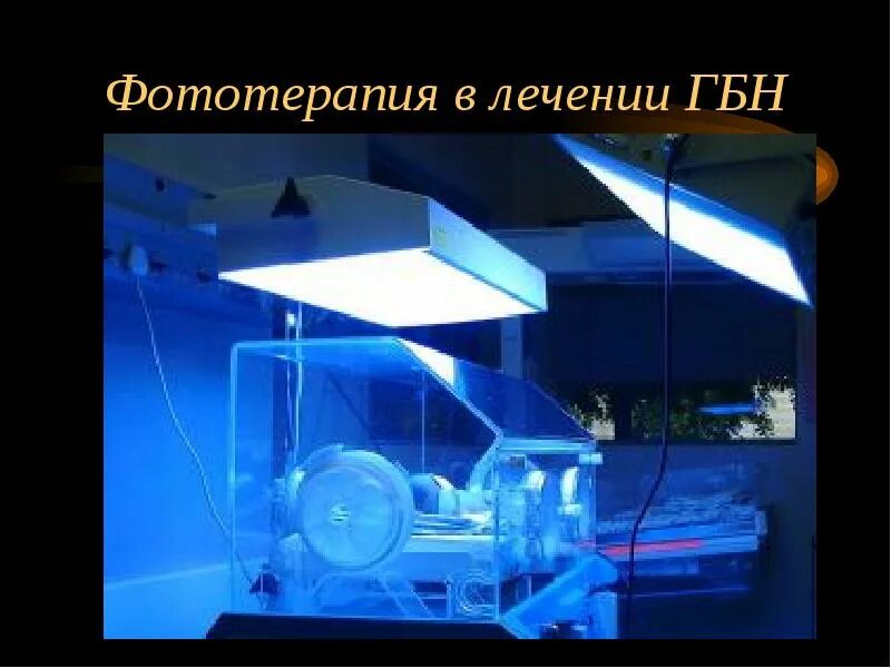 Фототерапия алгоритм. Фототерапия при гемолитической болезни. лечение гбн фототерапия. фототерапия при гемолитической болезни новорождённых..