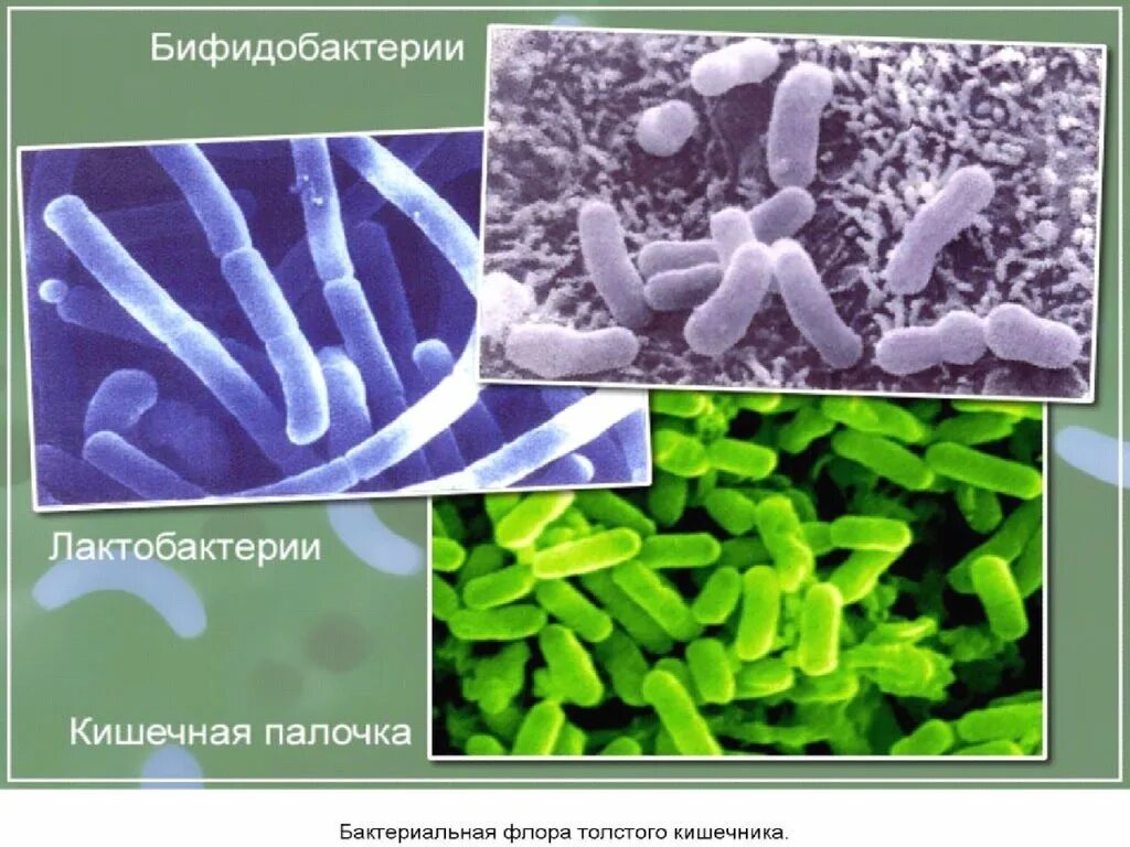 Бифидобактерии где. Бифидобактерии. Бактерии для микрофлоры кишечника. Бифидобактерии для кишечника.