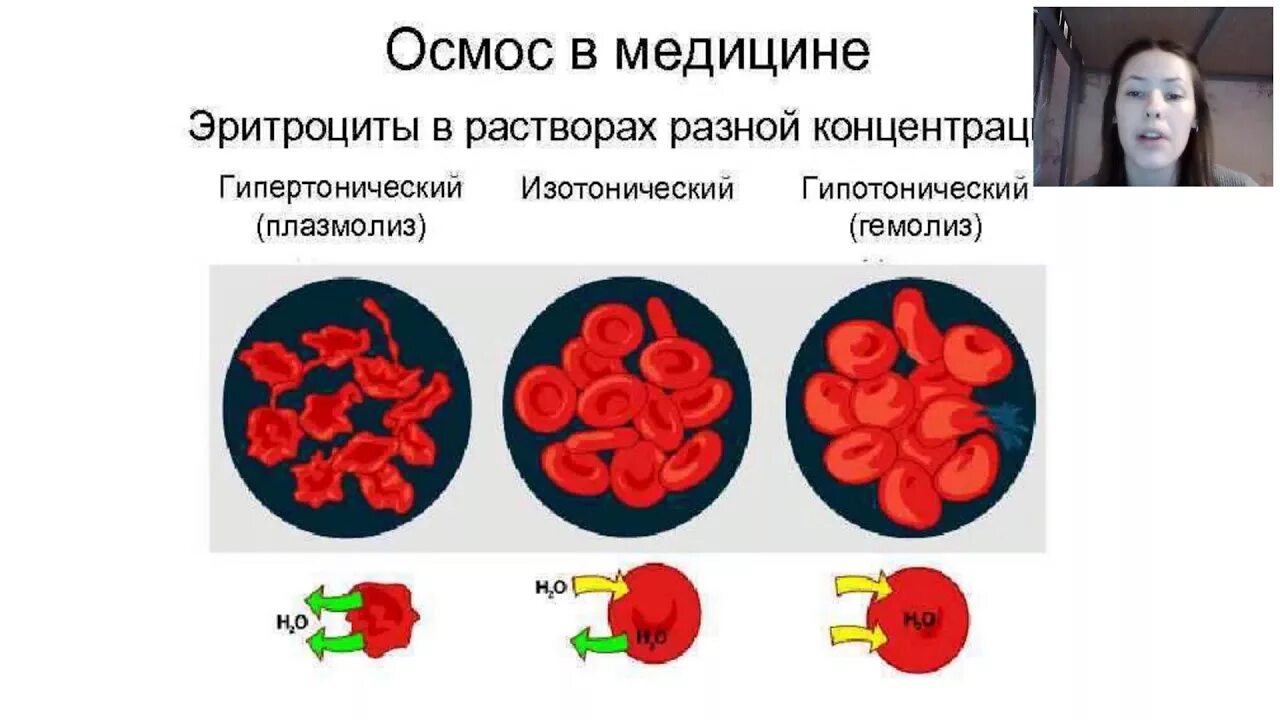 Эритроциты в растворе хлорида натрия. Гипертонический раствор эритроциты. Гемолиз и плазмолиз эритроцитов. Гипертонический раствор эритроцуи. Эритроциты в гипотоническом растворе.