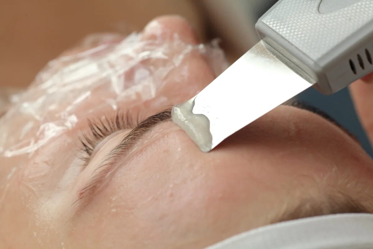 Ультразвуковая чистка лица. Ультразвуковой пилинг лица. Ультразвуковая чистка. Пилинг после уз чистки. Ультразвуковая чистка лица.