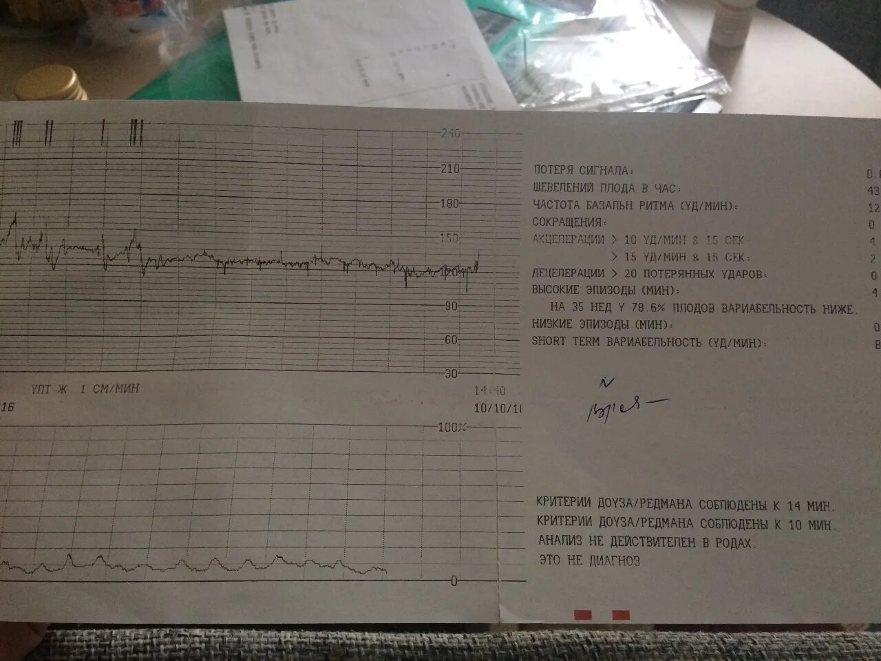 Шевеление плода 30 недель. Шевелений плода в час. Шевеления плода на КТГ. Норма шевелений плода при КТГ. КТГ шевеления плода в час норма.