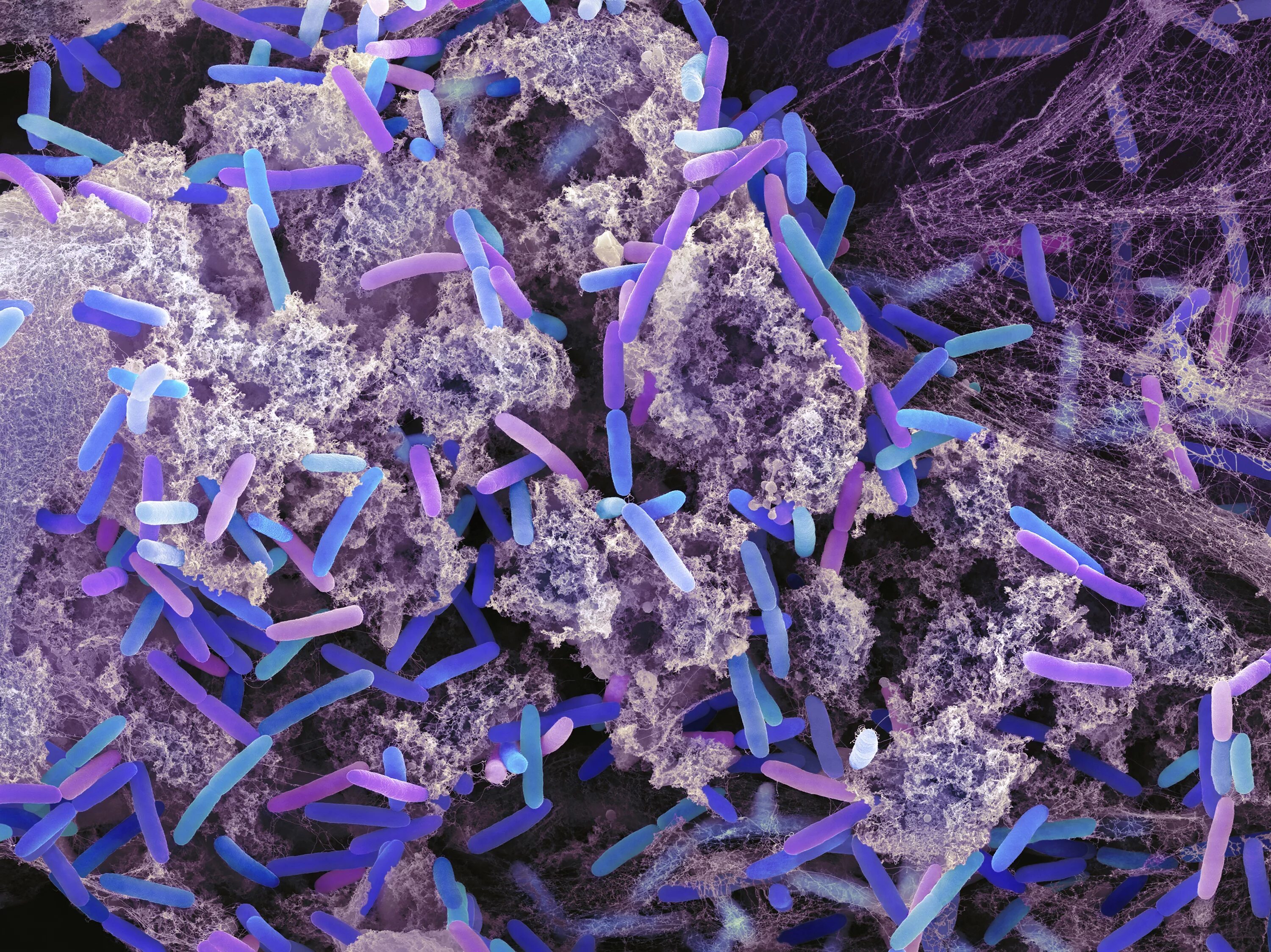 Бактерия чужеродная. Бактерия Pseudomonas aeruginosa. Синегнойная палочка под микроскопом. Синегнойная палочка микроскопия. Синегнойная палочка биопленка.