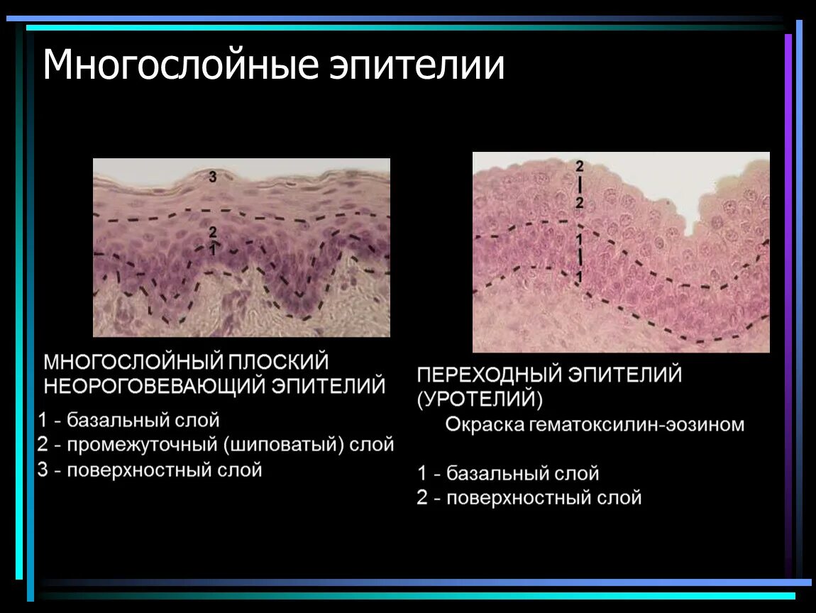 Слои переходного эпителия. Многослойный плоский неороговевающий эпителий и переходный. Многослойный плоский неороговевающий эпителий строение. Многослойный плоский неороговевающий эпителий местоположение. Многослойный плоский эпителий функции.