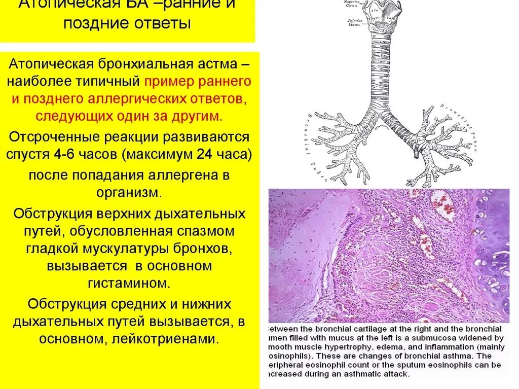 Бронхит история. Бронхиальная астма атопическая и неатопическая форма. Атопическая форма бронхиальной астмы. Причины атопической бронхиальной астмы. Бронхиальную астму атопического генеза характеризуют реакции.