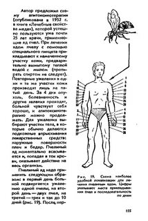 Точек пчел