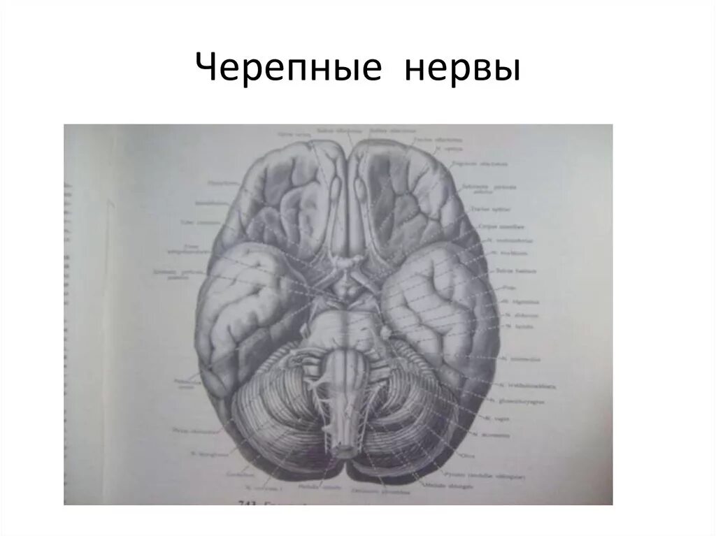 Узлы черепных нервов. Черепные нервы на мозге. Шулешова н.в. "Черепные нервы". 6-8 Черепные нервы головной мозг человека. 12 Черепных нервов учебник.