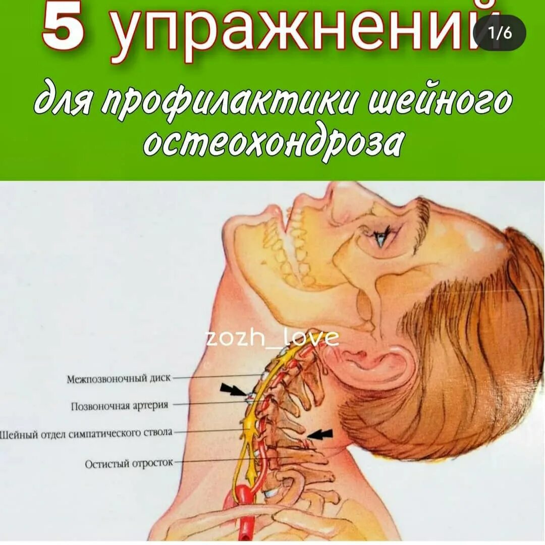 Хандроз или хондроз симптомы. Шейный остеохондроз. Упражнения для предупреждения шейного остеохондроза. Остеохондроз шейного отдела симптомы. Симптомы остеохондроза шейного отдела позвоночника.