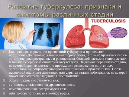 Проявление симптомов туберкулеза
