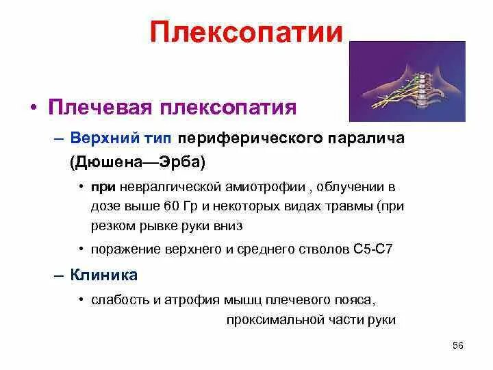Лечение плечевой плексопатии. Плексопатия плечевого нерва. Синдром поражения верхнего ствола плечевого сплетения. Лечение плечевой плексопатии. С.