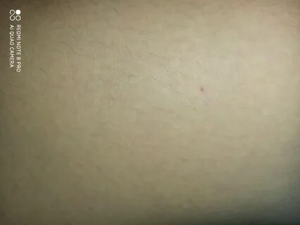 Единичные мелкие