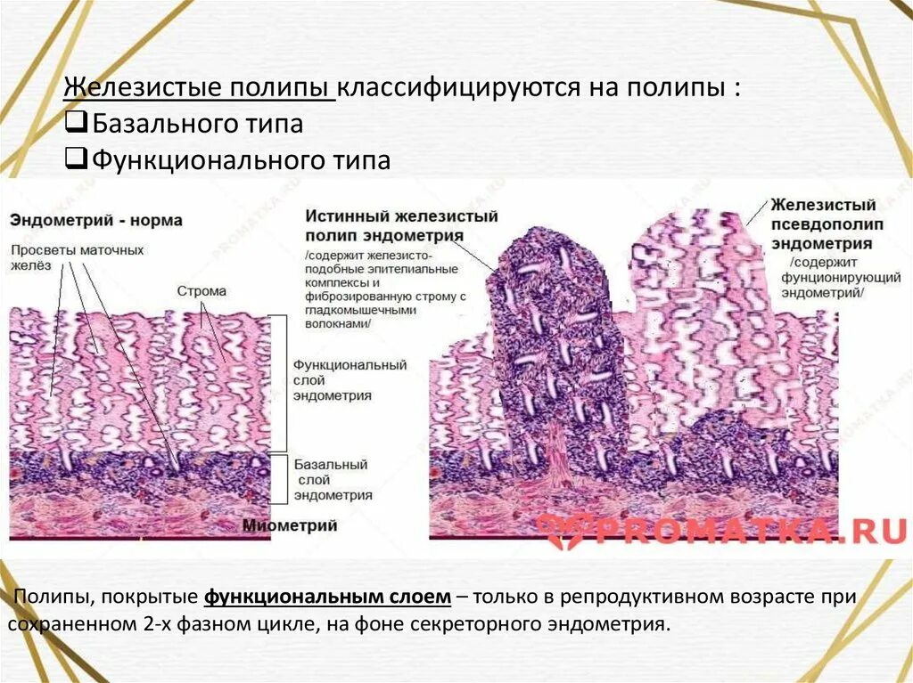 Формы гиперплазии характеристика пример Нейроэндокринные синдромы в гинекологии презентация онлайн