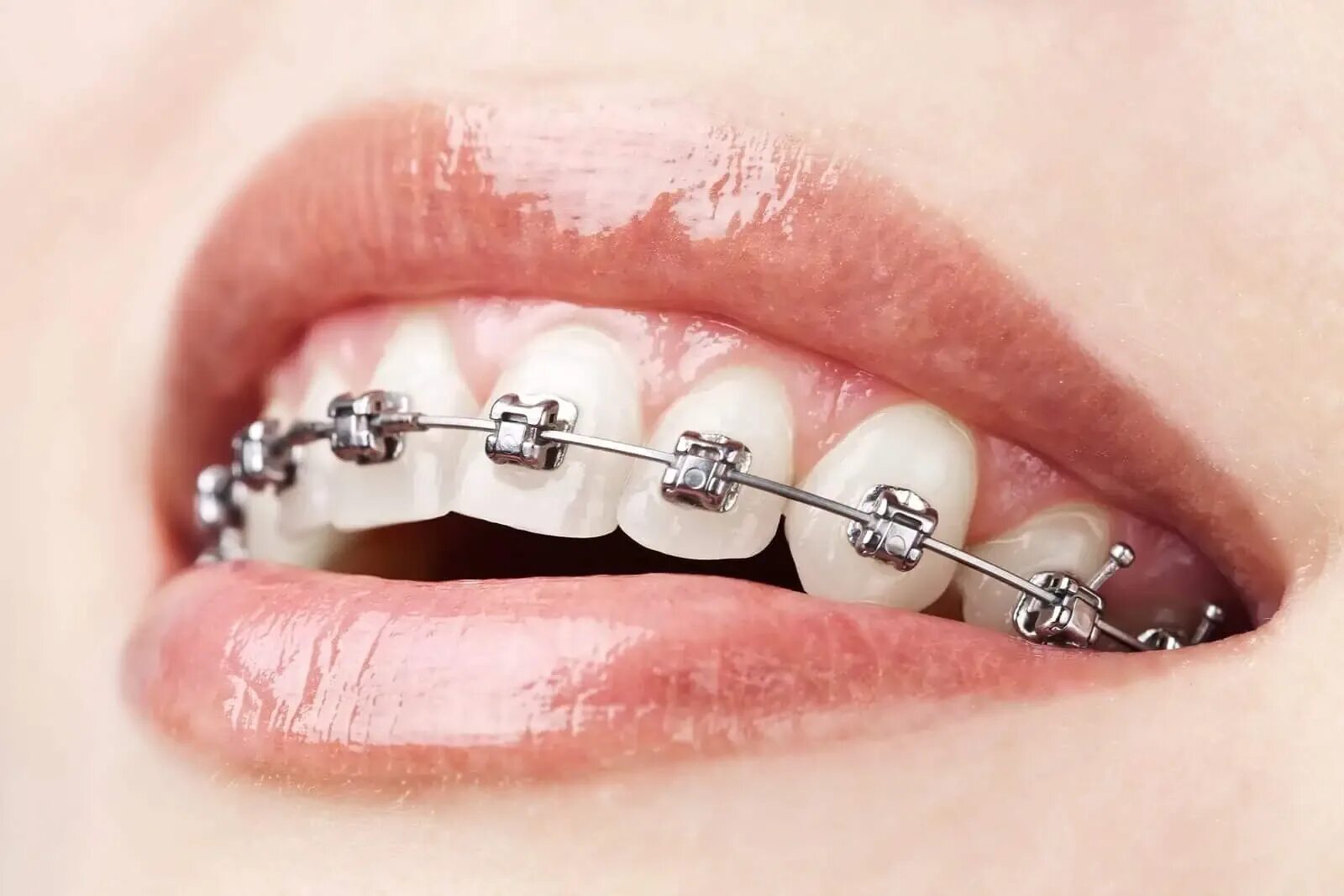 Matching brackets