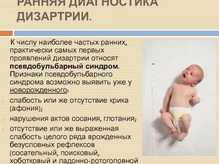 Признаки дцп у новорожденного в 1