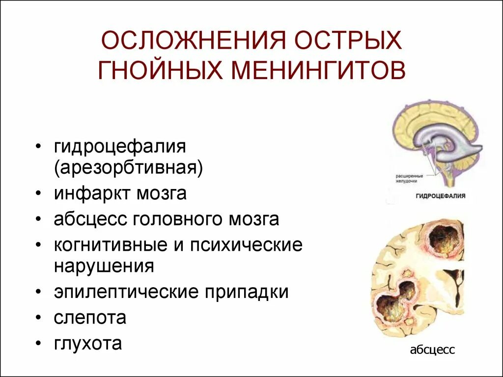 Последствия менингита у взрослых