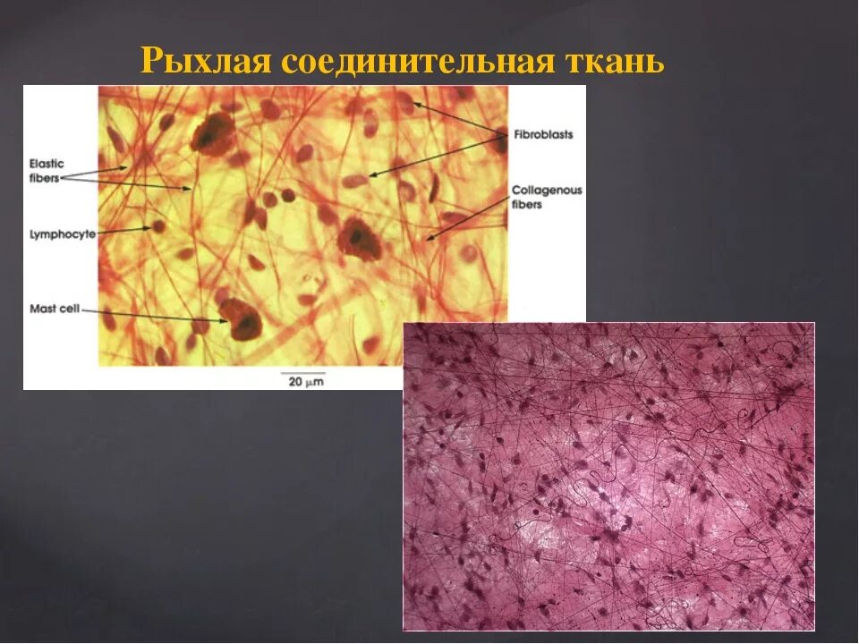 Примерами соединительной ткани являются хрящевая эндотелий гладкомышечная - найд