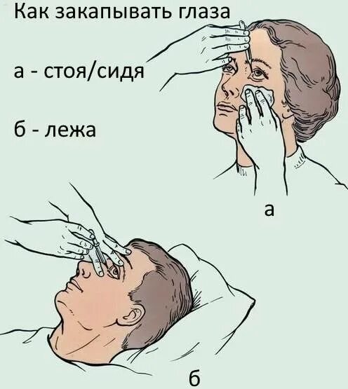 Как правильно закапывать капли в глаза. Закапывание капель в глаза. Как правильно капать капли в глаза. Капает капли в глаза.