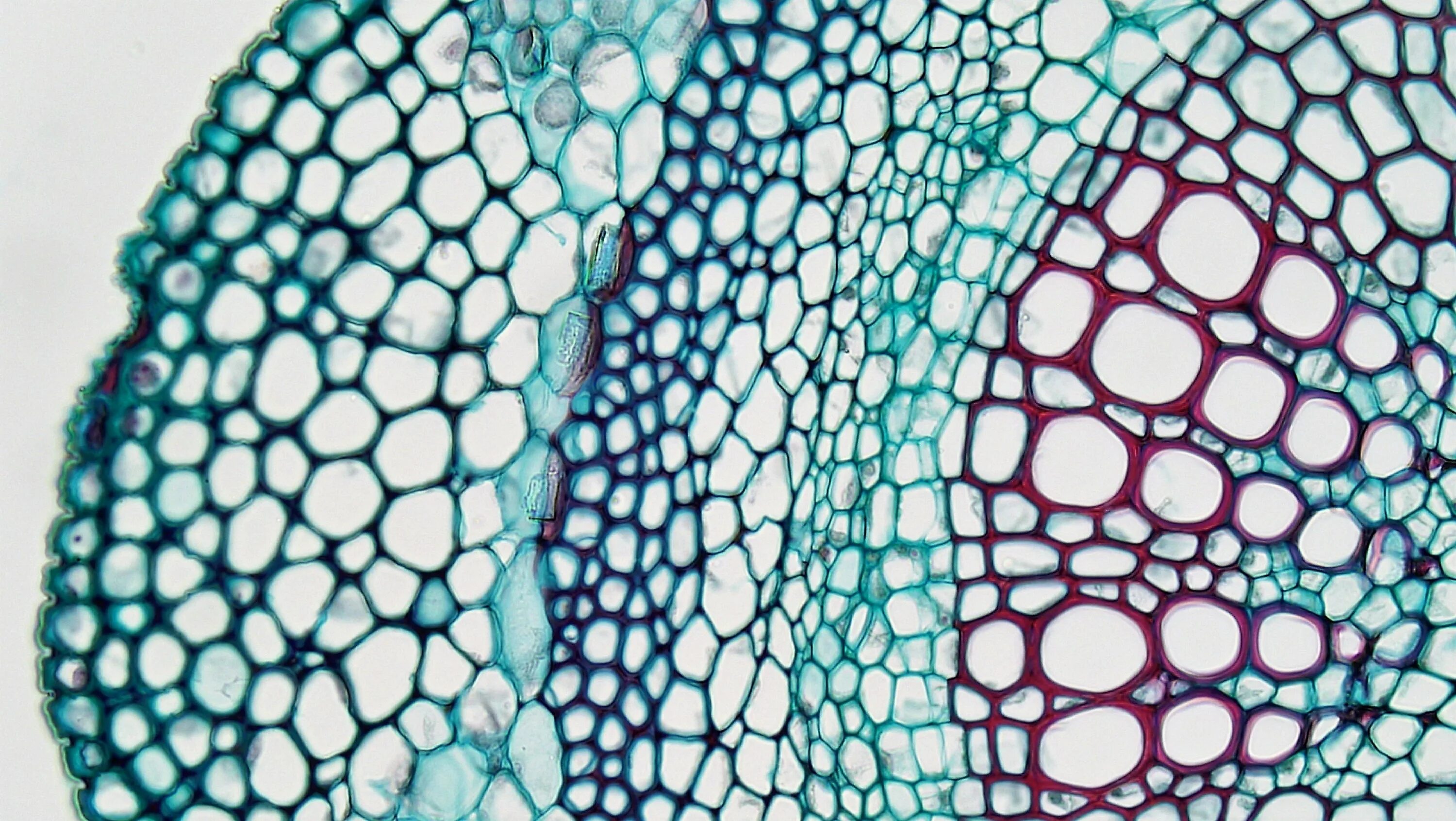 Строение живой ткани. Клетки склеренхимы. Склеренхима ткани растений. Колленхима и склеренхима. Ксилема микроскоп.
