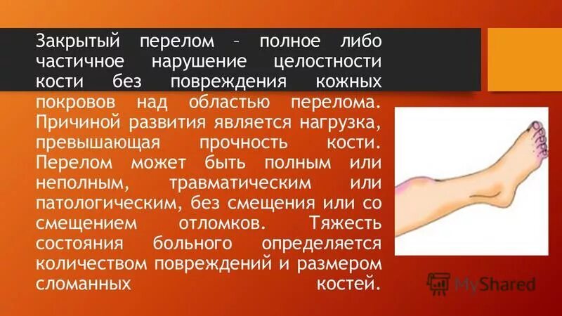 Мкб 10 открытый перелом. Причины закрытого перелома. Закрытый перелом костей. Открытый перелом кости.