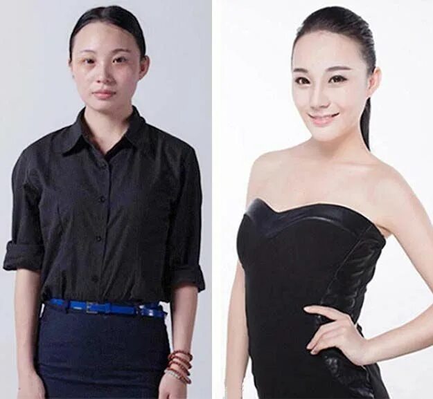 17 chinoises avant et après la chirurgie esthétique ! - Breakforbuzz Chirurgie e