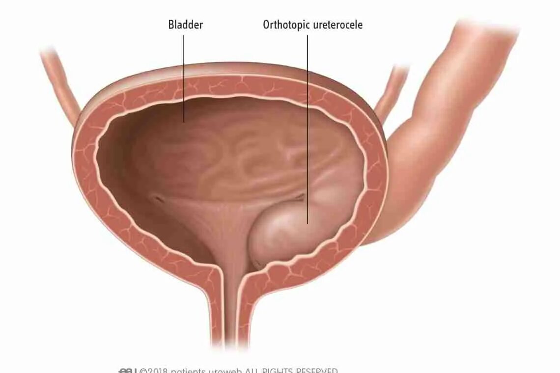 Как проверить мочевой пузырь у женщин. Как проверить мочевой пузырь у женщин. Как проверить мочевой пузырь у женщин. Как проверить мочевой пузырь у женщин. Нейрогенный мочевой пузырь этиология.