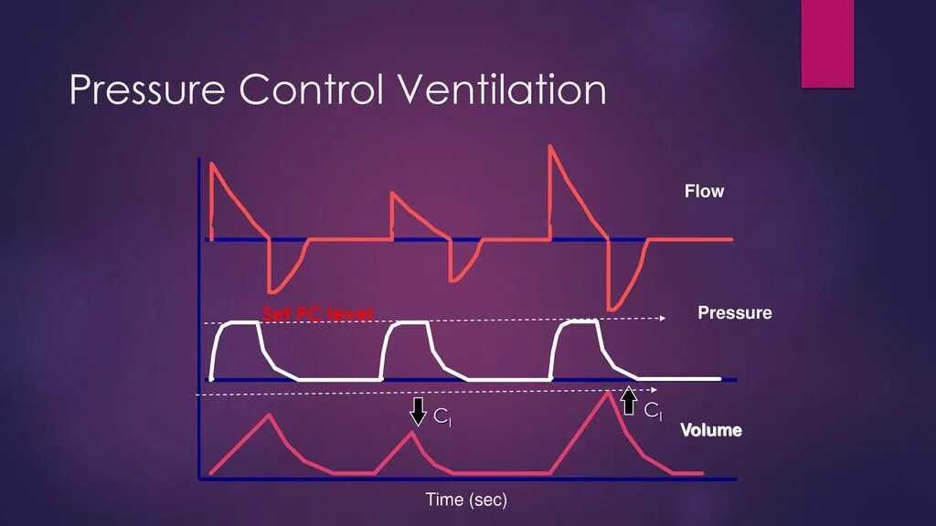 Pressure Control Ventilation. Pressure Control Ventilation режим. Mechanical Ventilation Modes. Volume Control Ventilation. Volume support