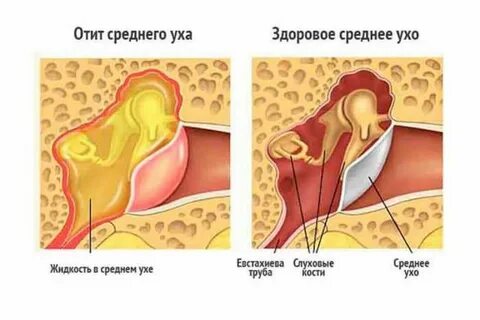 Почему болит ухо когда трогаешь