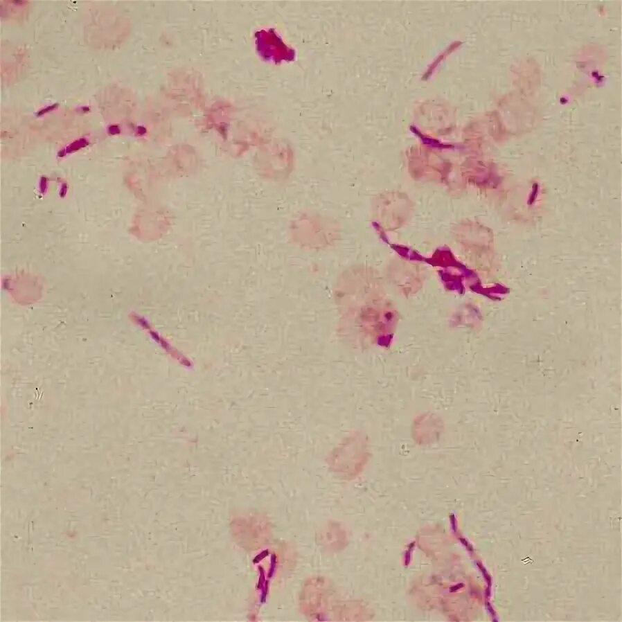 Fusobacterium spp. Bacteroides spp.: морфология. бактероиды по граму. бактероиды микробиология. bacteroides spp микроскопия.