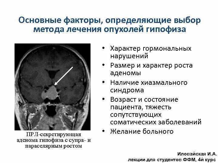 Симптомы гипофиз у мужчин. Клиника аденомы гипофиза неврология. Аденома гипофиза РКТ. Доброкачественные новообразования гипофиза (пролактиномы и аденомы).. Лекарство при микроаденоме гипофиза.