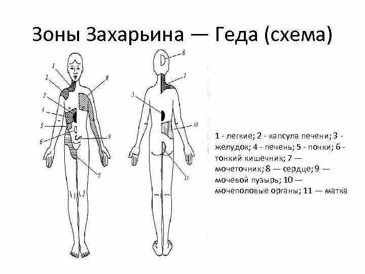 Дерматомы тела человека зоны захарьина геда. Дерматомы тела человека зоны захарьина геда. Захарьина. Захарьина. Проекционные зоны захарьина-геда схема.