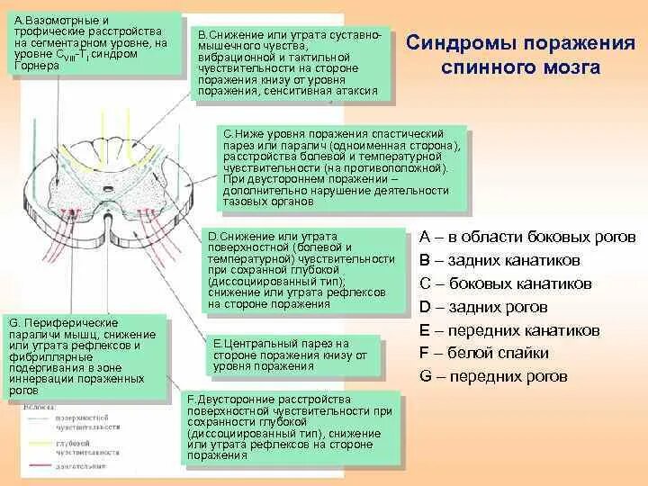 Поражение сегментов спинного мозга. Синдром поражения передних и задних Корешков спинного мозга. Поражение заднего рога спинного мозга неврология. Поражение боковых канатиков спинного мозга.