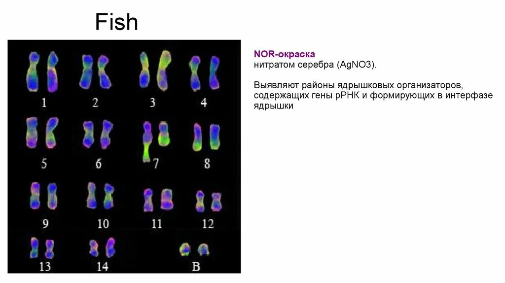 Изменение окраски хромосом. T окрашивание хромосом. Nor окрашивание хромосом. Ядрышковая хромосома. Ядрышковые организаторы хромосомы.