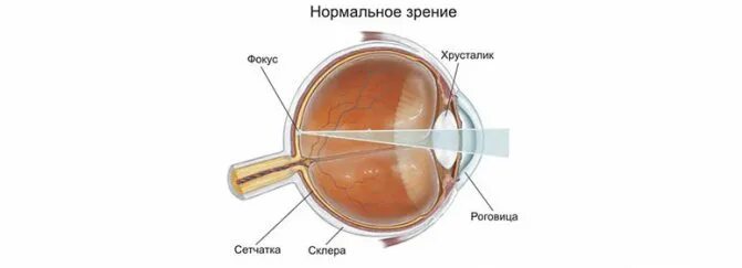 Зрение 1 2. Зрение -2.5. зрение минус. зрение минус 3. зрение -1.5.