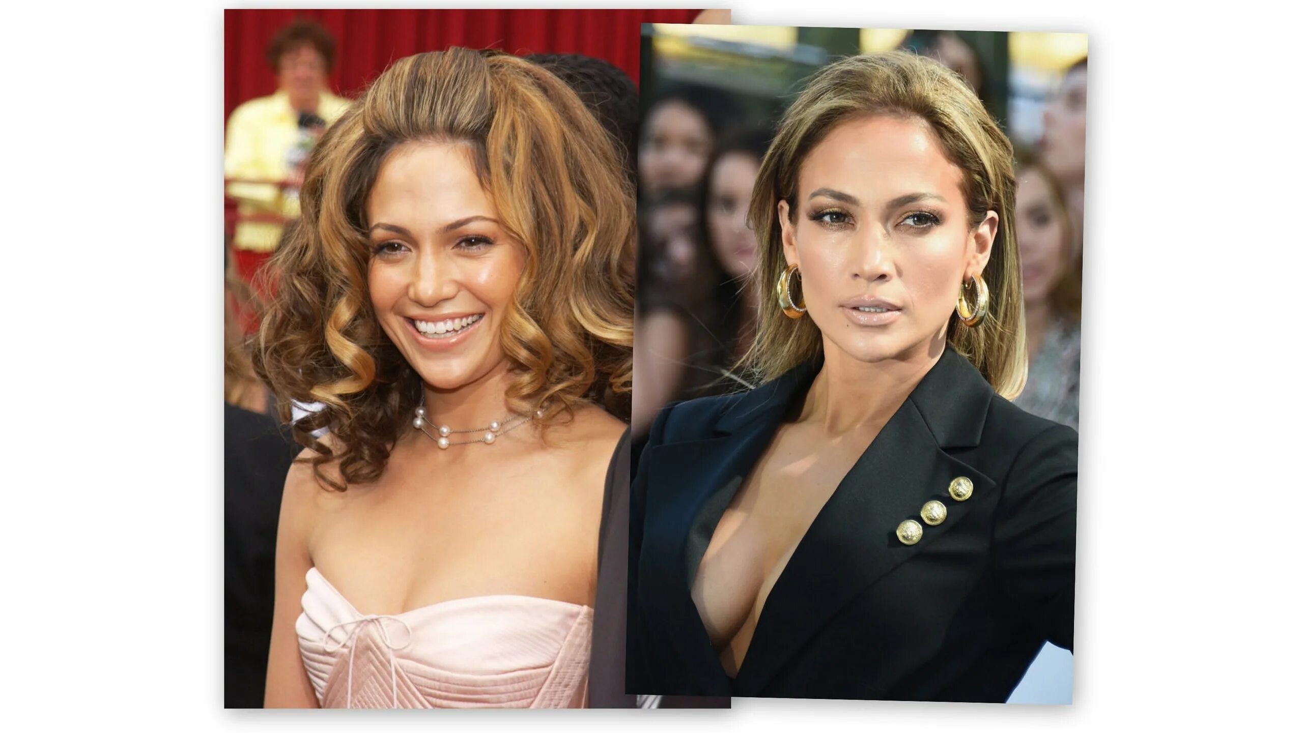 Дженнифер лопес пластические операции. Дженнифер лопес до пластики в молодости. Дженнифер лопез ринопластика. Пластика дженнифер лопез. Дженнифер лопес до пластики в молодости.