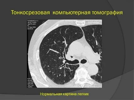 Кт количество срезов