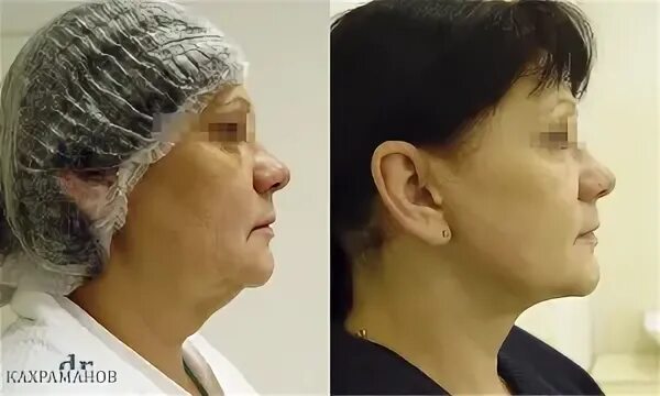 Кахраманов пластический хирург. Кахраманов пластический хирург