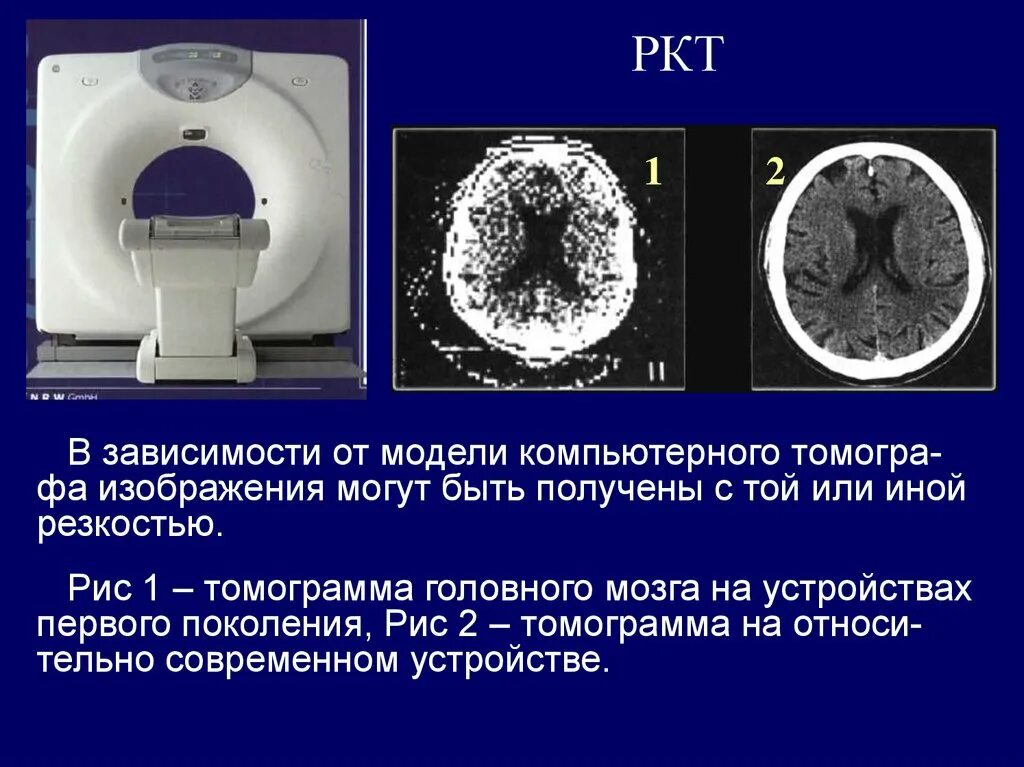 Что такое ркт. Рентгеновская компьютерная томография. Рентгеновская компьютерная томография (РКТ). РКТ аппарат. РКТ это в медицине.