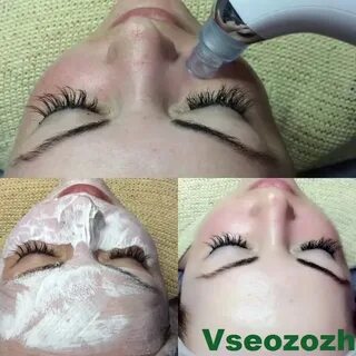Вакуумная чистка после замершей