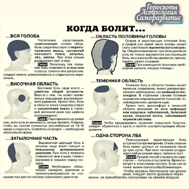 Давление болит голова и глаза. Типы головной боли. Головная боль картинки с описанием. Таблица головной боли. Таблица боли головы.